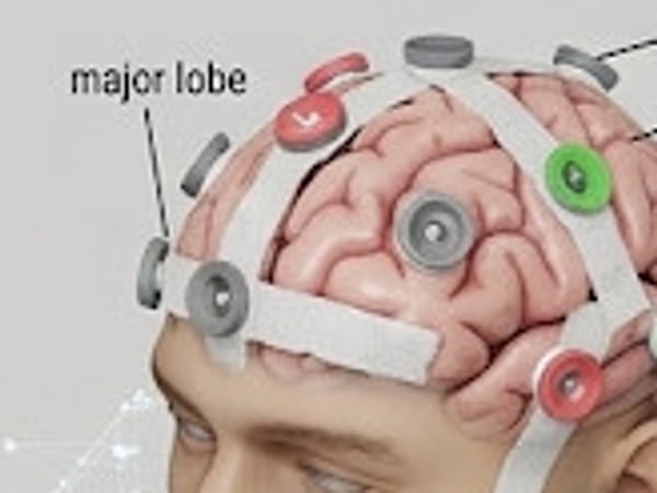 Illustration of a head wearing an EEG cap, with recording electrodes placed across the scalp